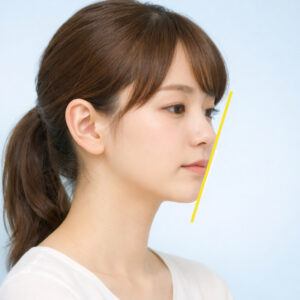 口ゴボ（上下顎前突）とは？【茨城県石岡市の矯正歯科医院・石岡みらい矯正歯科】