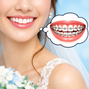 矯正治療中に結婚式が予定されている方へ。装置は外せる？後悔しないための現実的な選択肢について